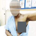 •A breast cancer patient -Please blur face and chest.