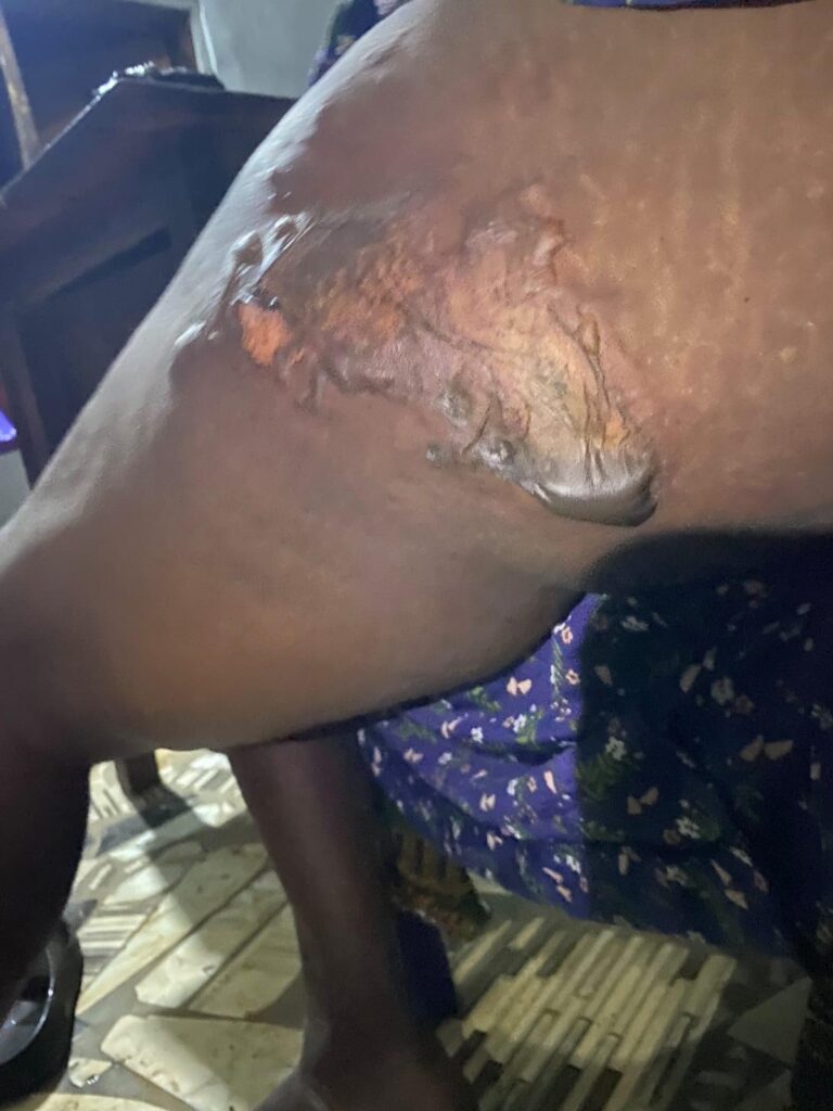 Mrs Amina Iduh on her hospital bed.