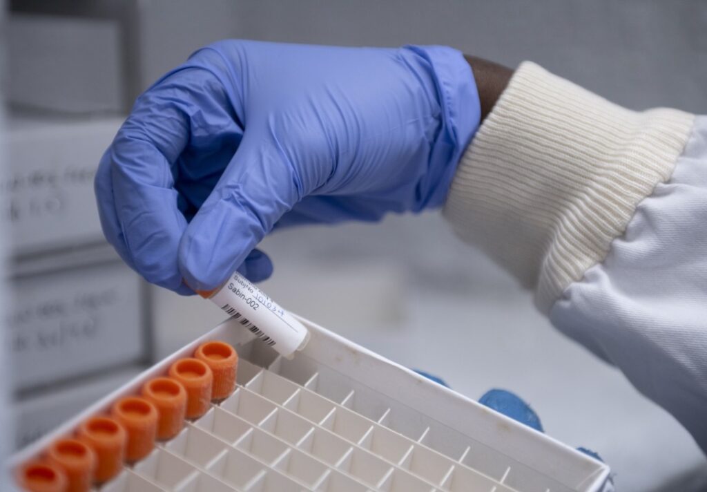 Phase2_Clinical_Trial_Marburg_Sabin_MUWRP_Kampala_Uganda_060-aspect-ratio-1035-720