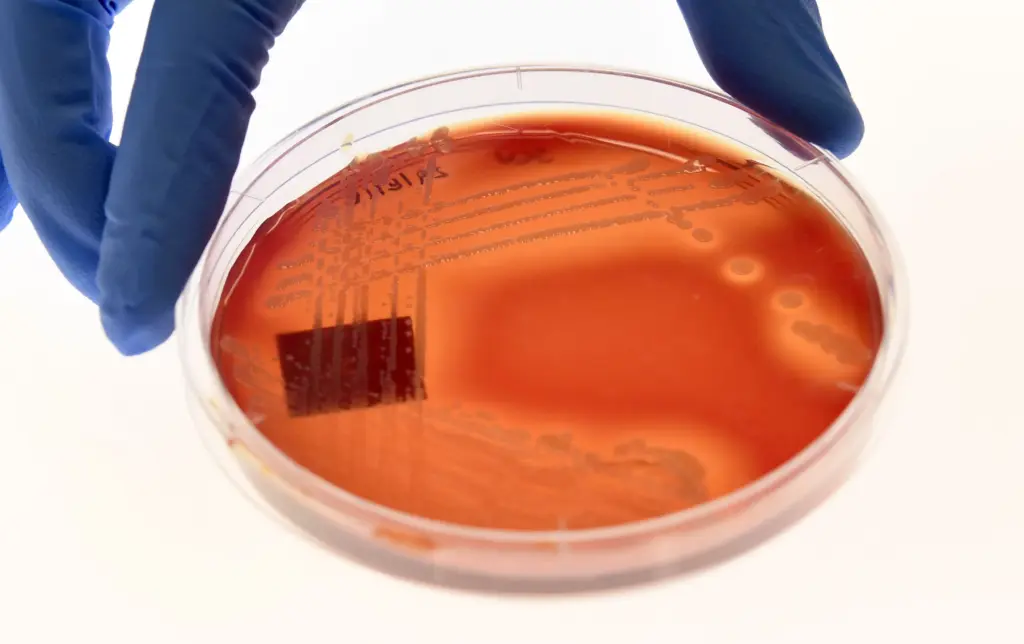Drug-resistant infections kill 2 every minute — WHO