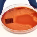 Drug-resistant infections kill 2 every minute — WHO