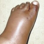 Leg