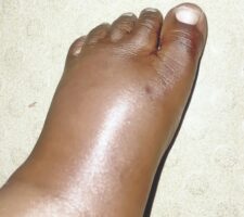 Leg