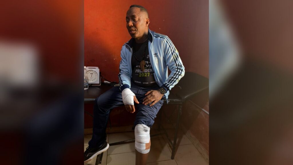Sowore injured in Ekiti altercation