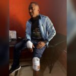 Sowore injured in Ekiti altercation