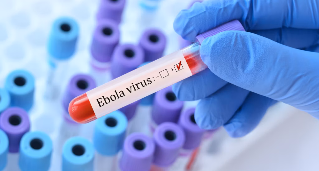 ebola-virus-test-gettyimages