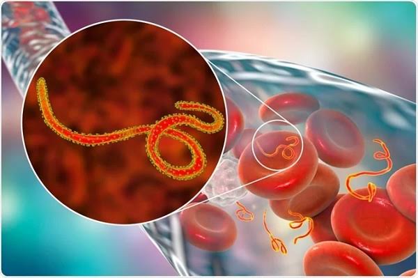 Nigeria’s Ebola patient likely contracted virus in Uganda – Switzerland